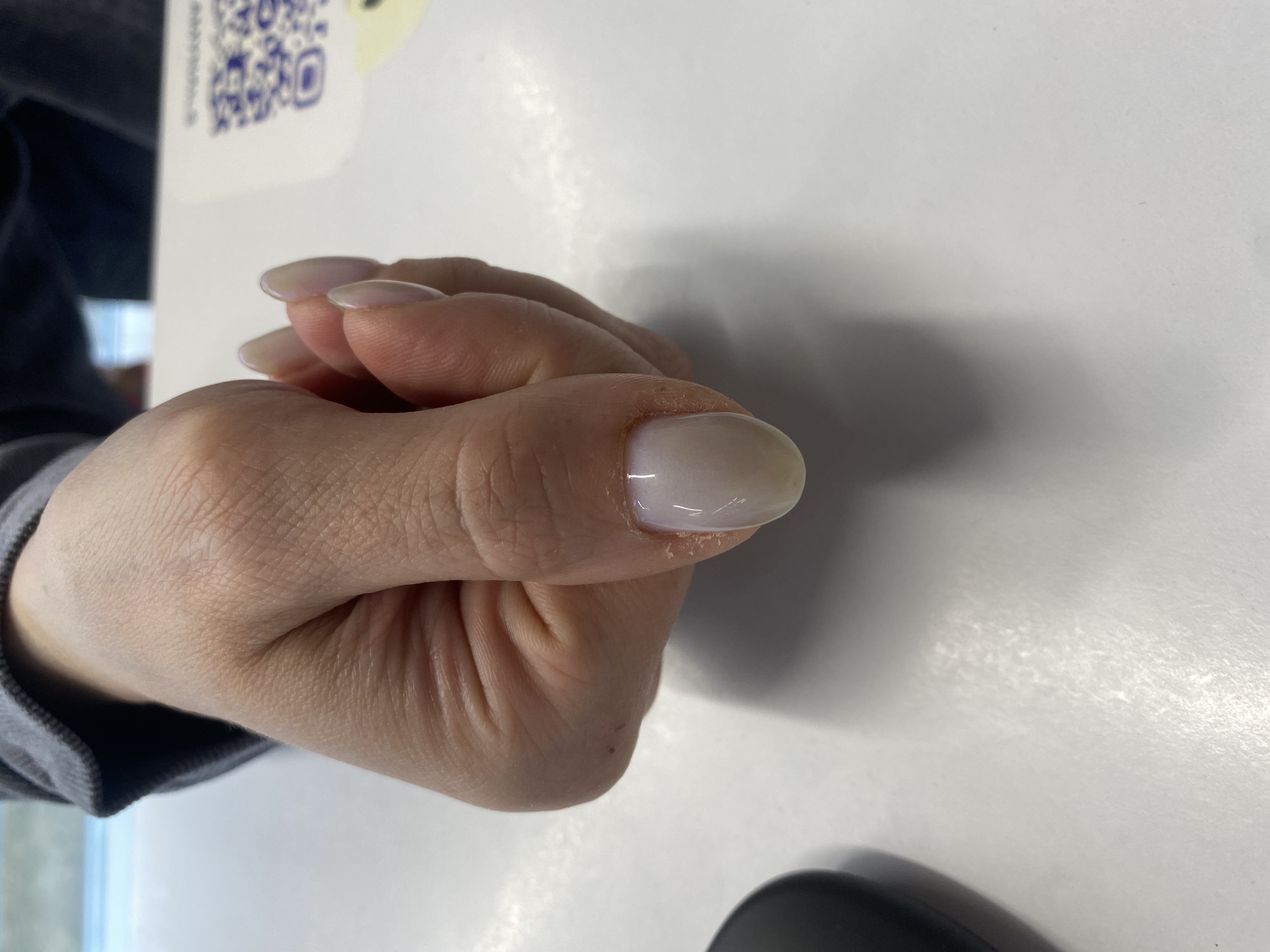 Гарантия 5 дней